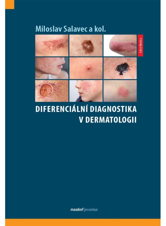 Diferenciální diagnostika v dermatologii