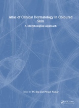 Atlas of Clinical Dermatology in Coloured Skin