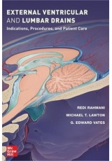 External Ventricular and Lumbar Drains: Indications, Procedures, and Patient Care