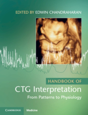 Handbook of CTG Interpretation, From Patterns to Physiology