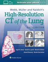 Webb, Muller and Naidich´s High-Resolution CT of the Lung